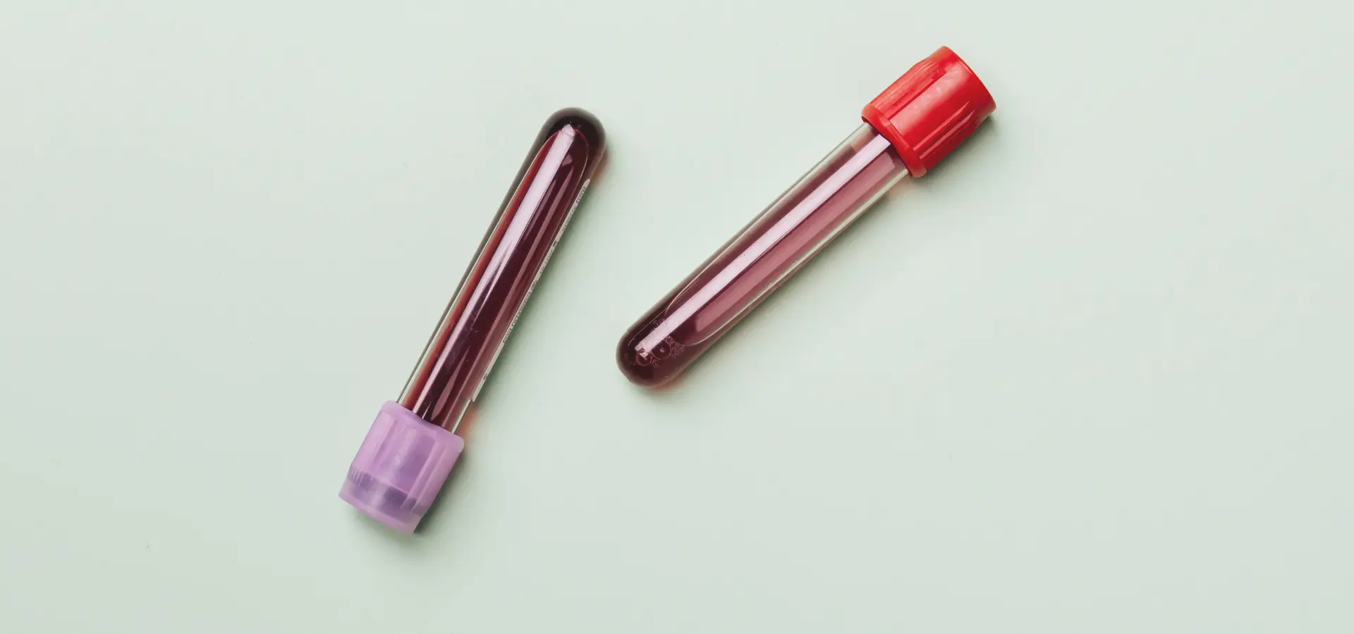 toma de muestras de sangre